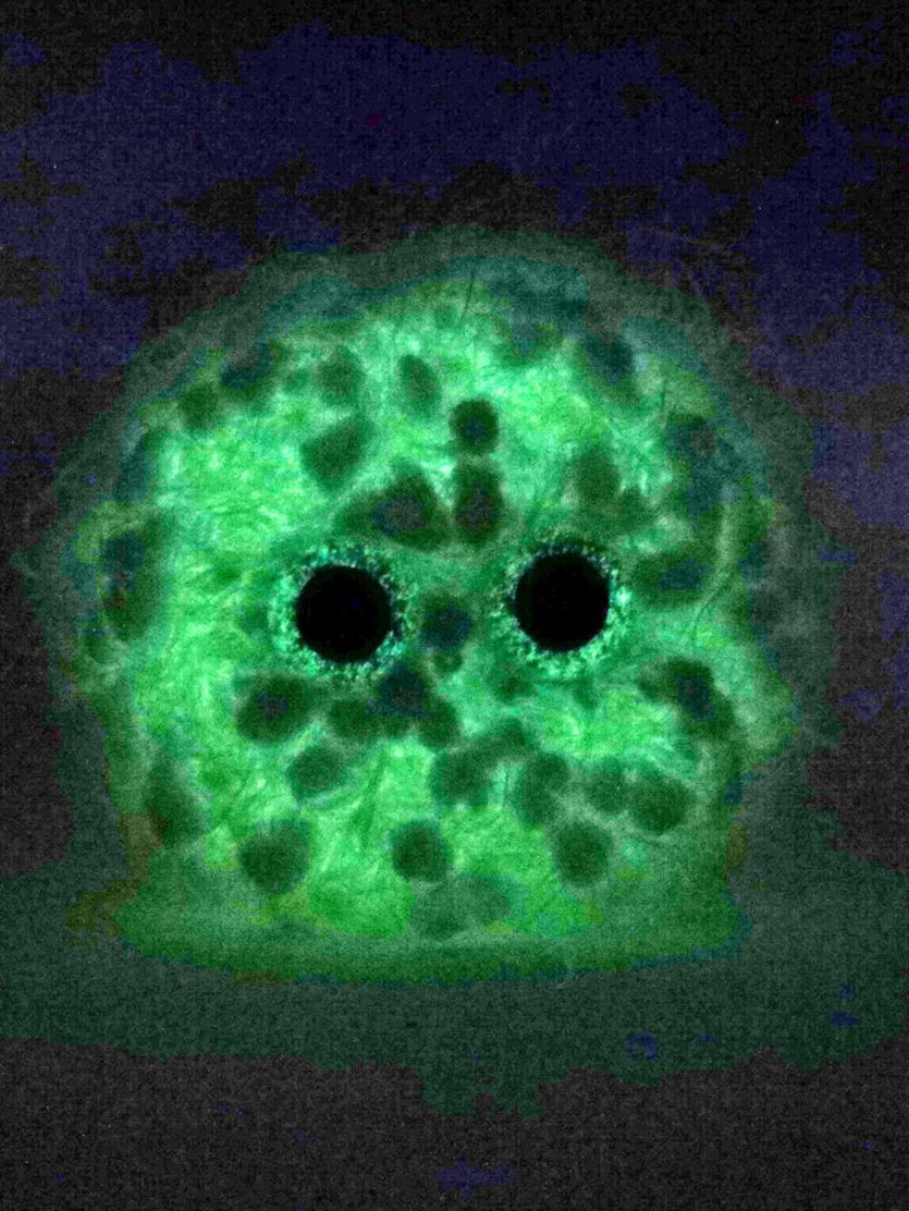 Buttfreckle - Picture 6 of 8